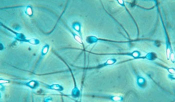 El gen del esperma tiene 600 millones de años